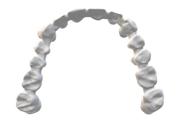 Crown, coping and bridge